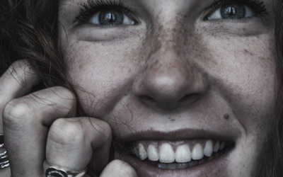Macchie bianche sui denti: cosa sono?